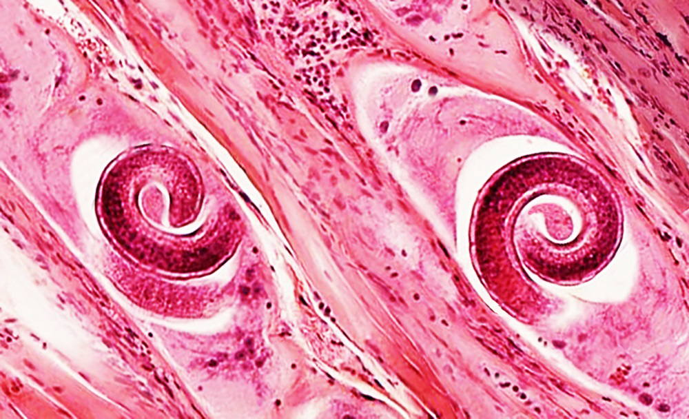 Личинки трихинеллы. Трихинелла спиральная - Trichinella spiralis. Трихинеллез свиней трихинеллоскопия. Трихинелла Спиралис в мясе.