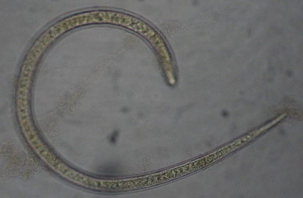 Трихинеллы – это одна из разновидностей первичноротых круглых паразитических червей