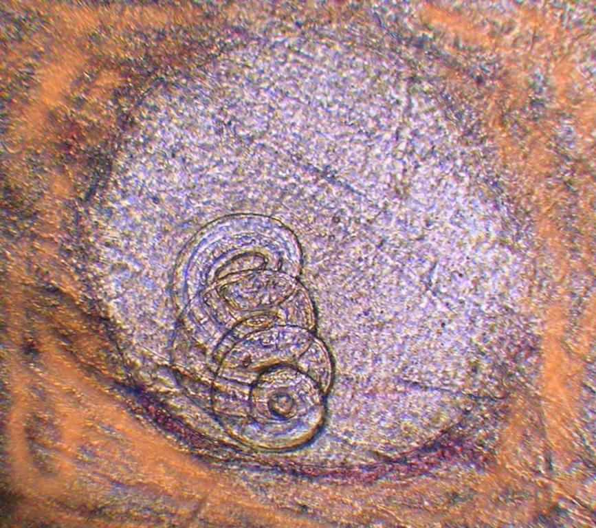 Как выглядит трихинеллез под микроскопом у кабана фото