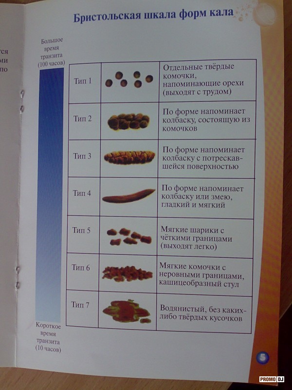 Стул по шкале бристоль