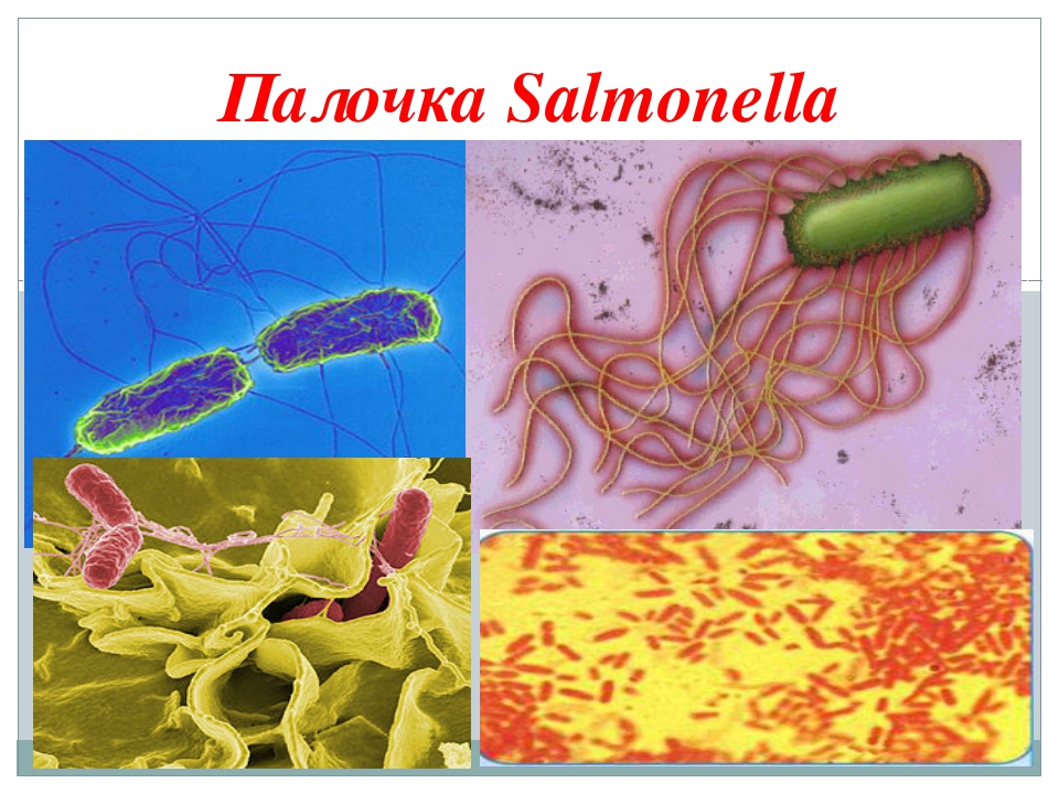 Salmonella enterica