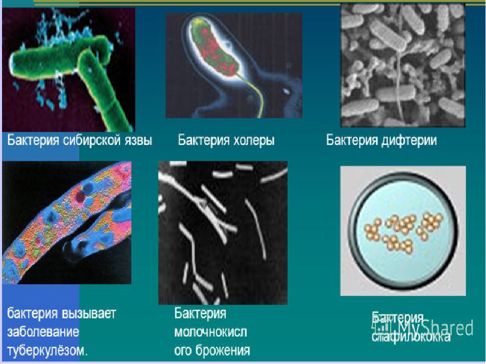 Микроорганизмы способные вызывать заболевания. Сибирская язва бактерия. Болезнетворные бактерии Сибирская язва. Бактерии вызывающие холеру. Сибирская язва возбудитель.