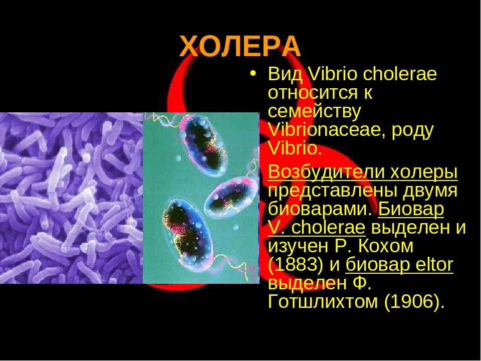 Виды холеры. Холерный вибрион это бактерия. Вибрион холеры анаэроб. Vibrio cholerae микробиология. Бактерии-паразиты холерный вибрион.