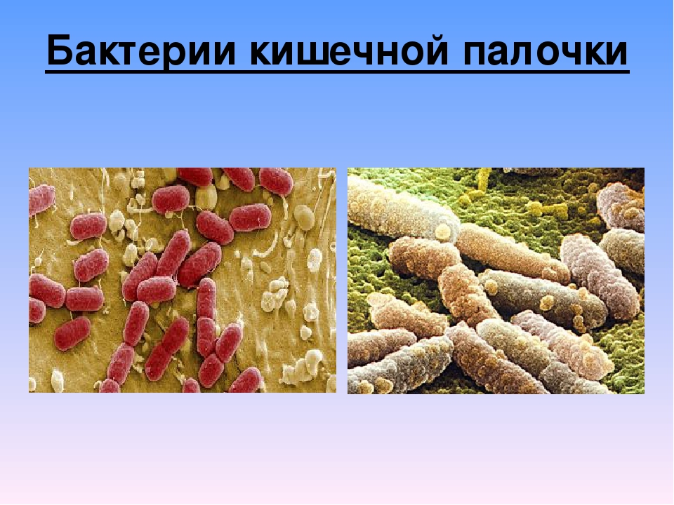 Микроорганизмы кишечная палочка