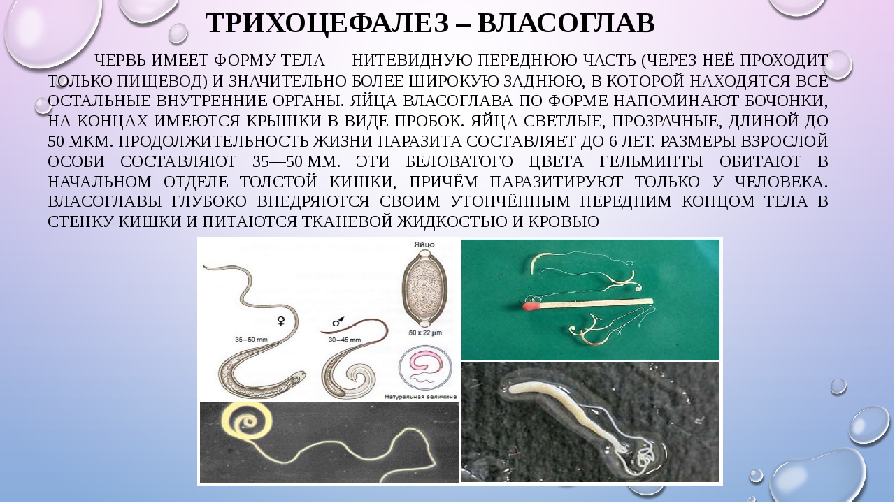 Круглые черви заболевания. Власоглав геогельминт. Круглые черви паразиты власоглав. Власоглав человеческий (Trichocephalus Trichiurus).