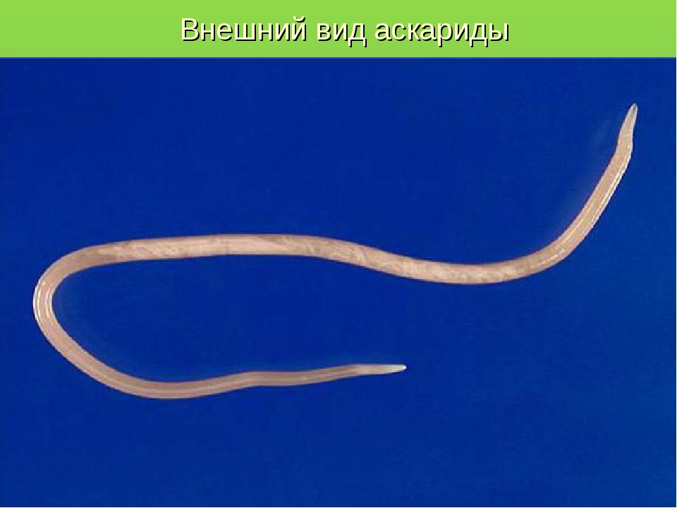 Аскарида тип. Круглые черви аскарида человеческая. Тип круглые черви аскарида человеческая. Нематода человеческая аскарида.