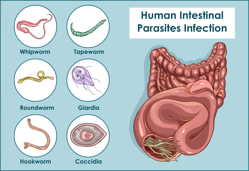 6 симптомов наличия паразитов кишечнике