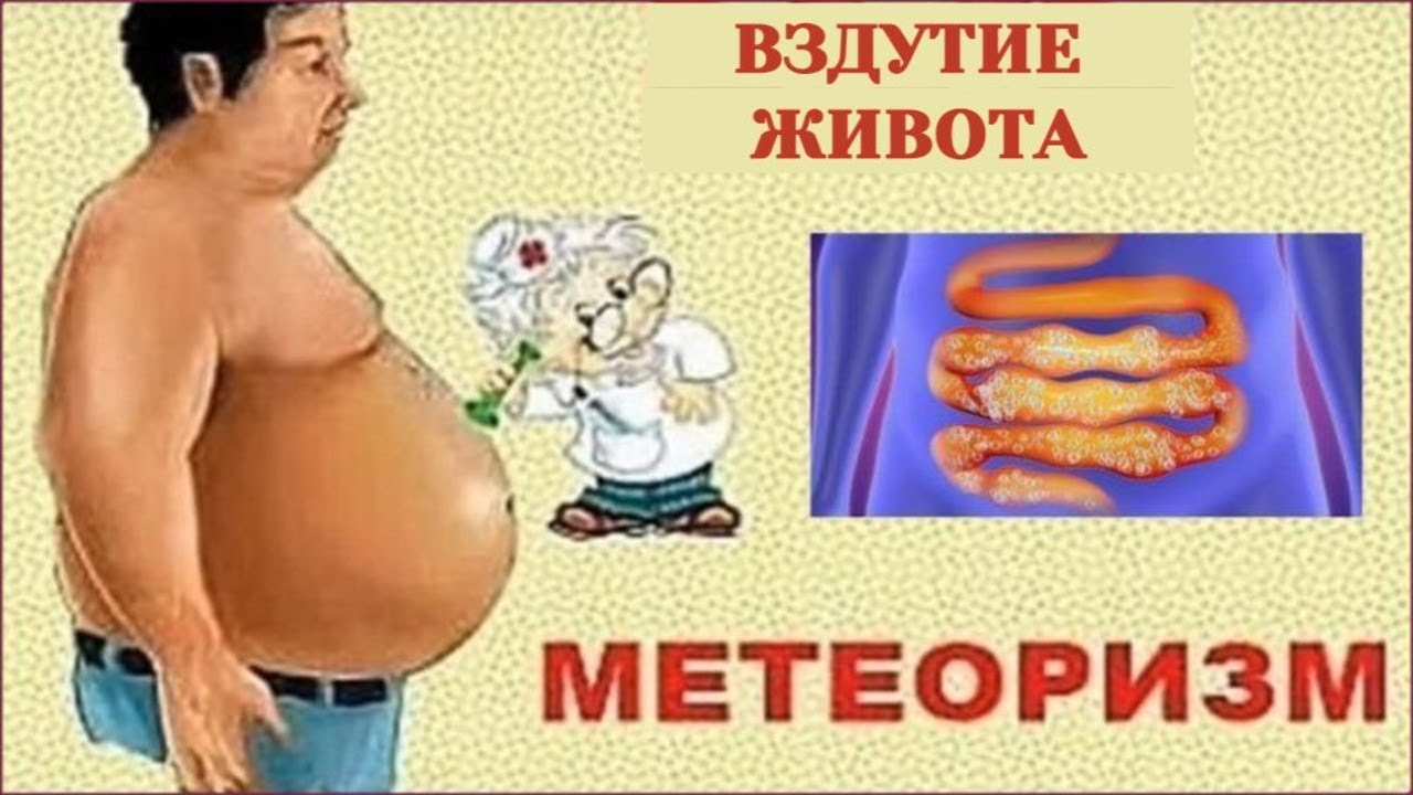 Метеоризм кишечника причины и лечение у мужчин. Метеоризм. Вздутие живота метеоризм.