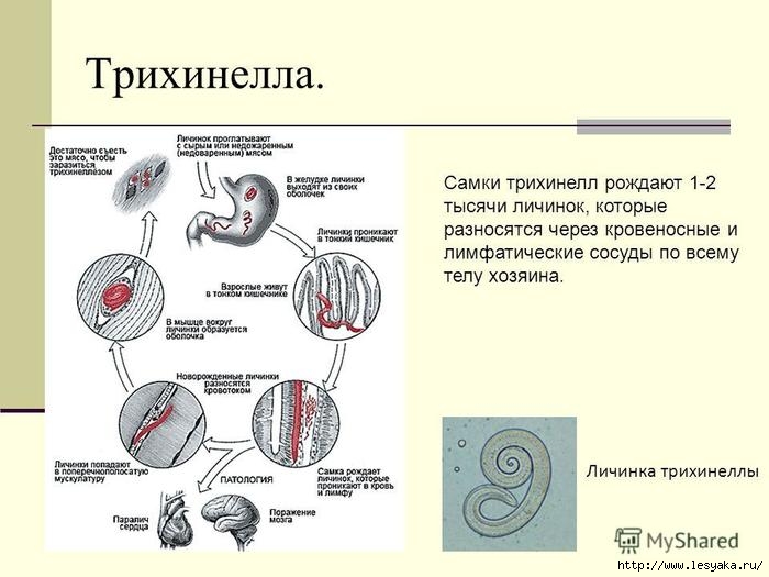 Схема цикла развития трихины