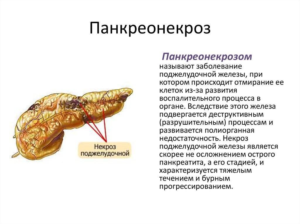 Патологии поджелудочной железы презентация