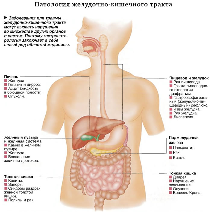 Где находится кишечник у человека фото и как болит симптомы у женщин