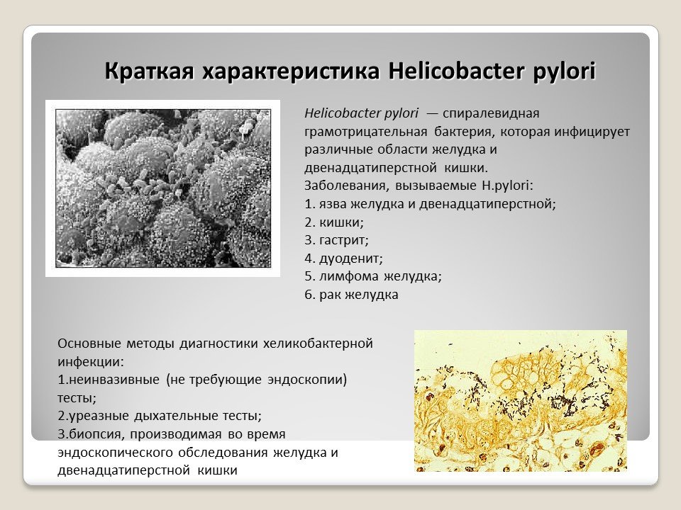 Infeccion por helicobacter pylori