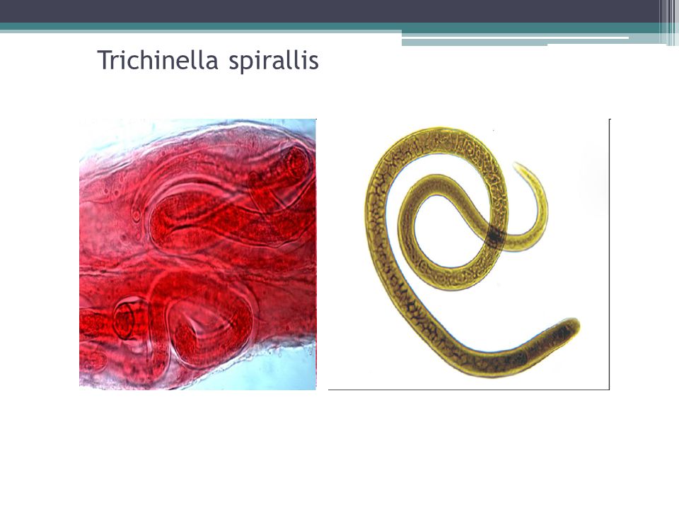 Спиральная трихинелла фото