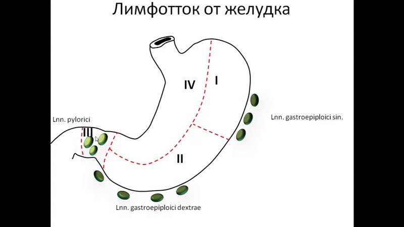 Лимфоотток желудка схема