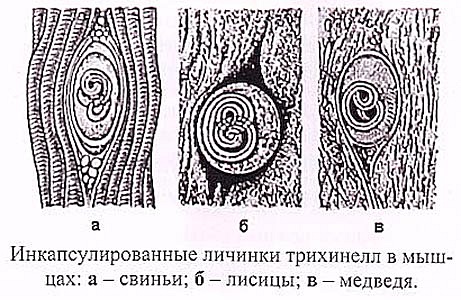 Инкапсулированные личинки трихинеллы в мышцах рисунок с обозначениями