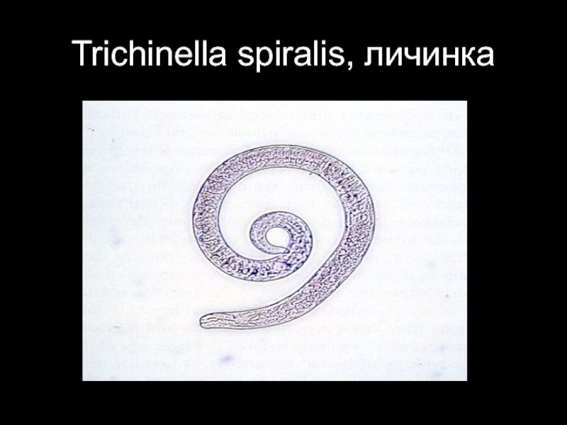 Trichinella spiralis. Трихинелла Спиралис рисунок. Личинка трихинеллы рисунок. Нематодозы (трихинеллез)..