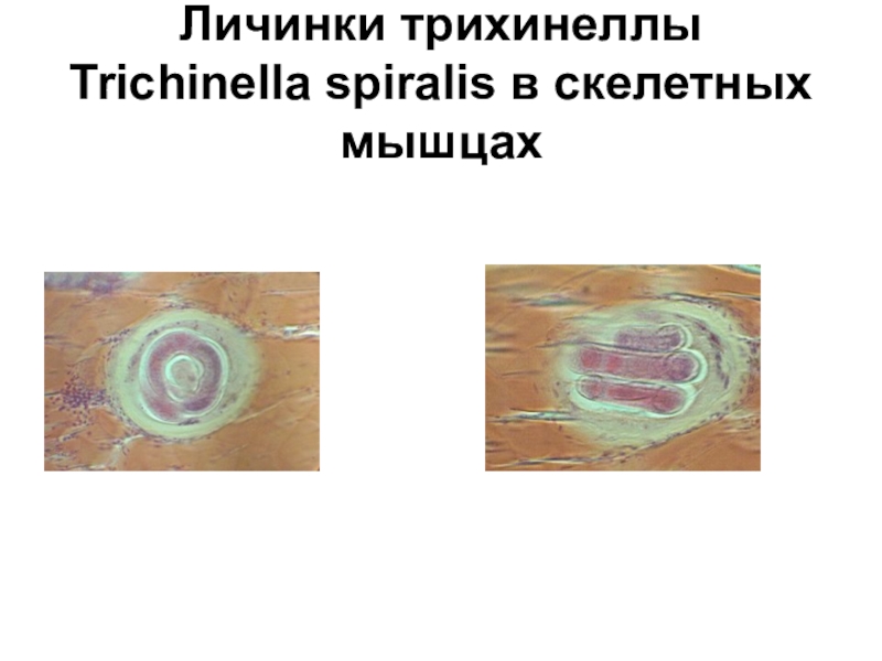 Личинка трихинеллы рисунок