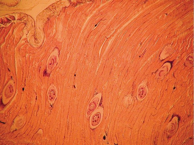 Как выглядит трихинеллез под микроскопом у кабана фото