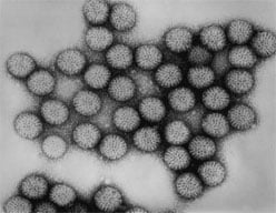 microscopic image of Rotavirus
