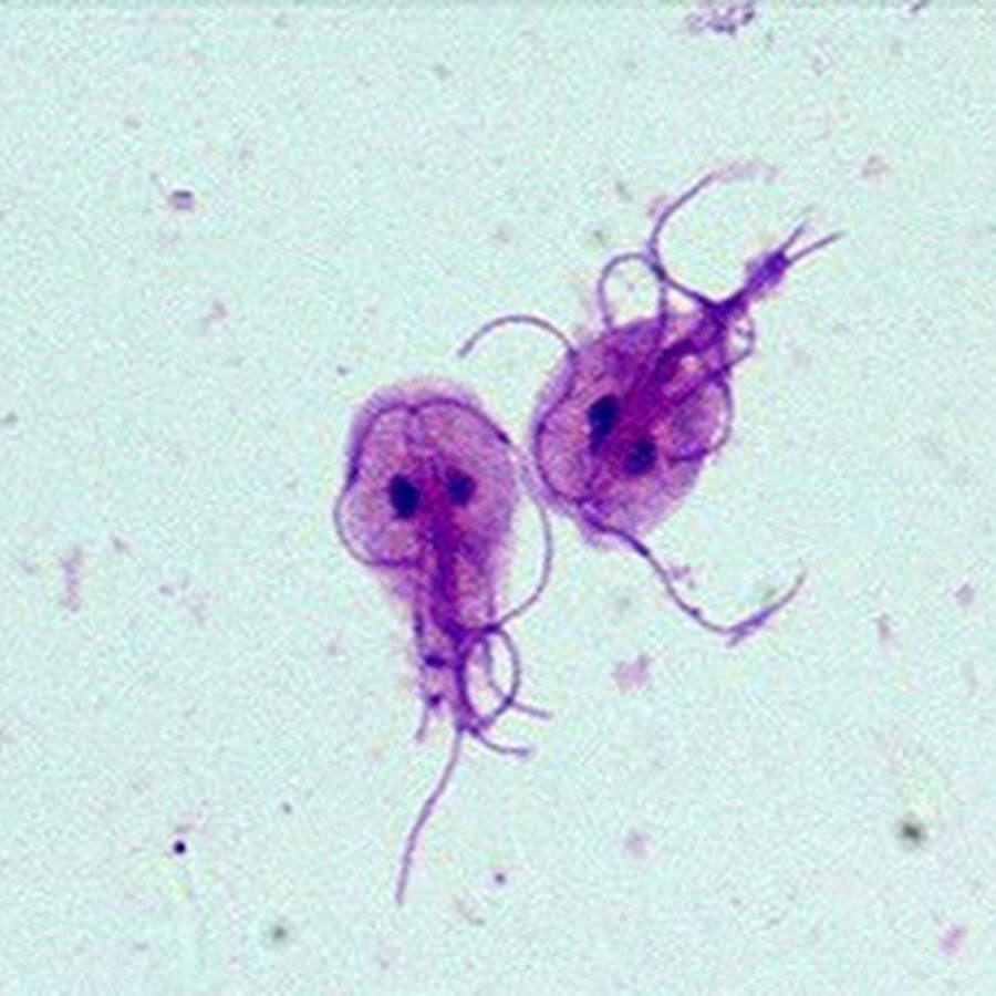 Лямбия. Лямблия интестиналис. Лямблия трофозоит. Lamblia intestinalis под микроскопом. Лямблия циста.