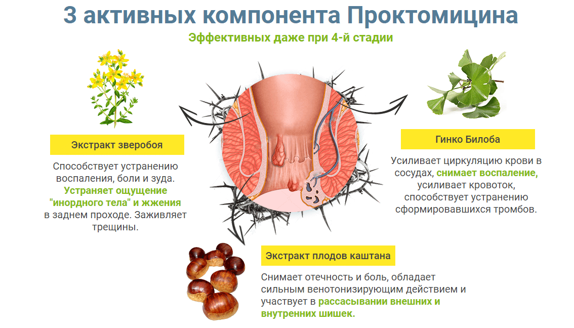 Лечение геморроя