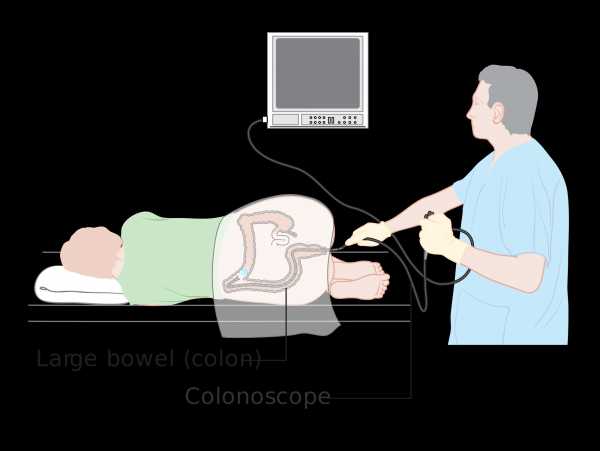 Вместо колоноскопии можно сделать. Виртуальная колоноскопия кишечника. Кт колоноскопия кишечника. Виртуальная колоноскопия методика проведения.